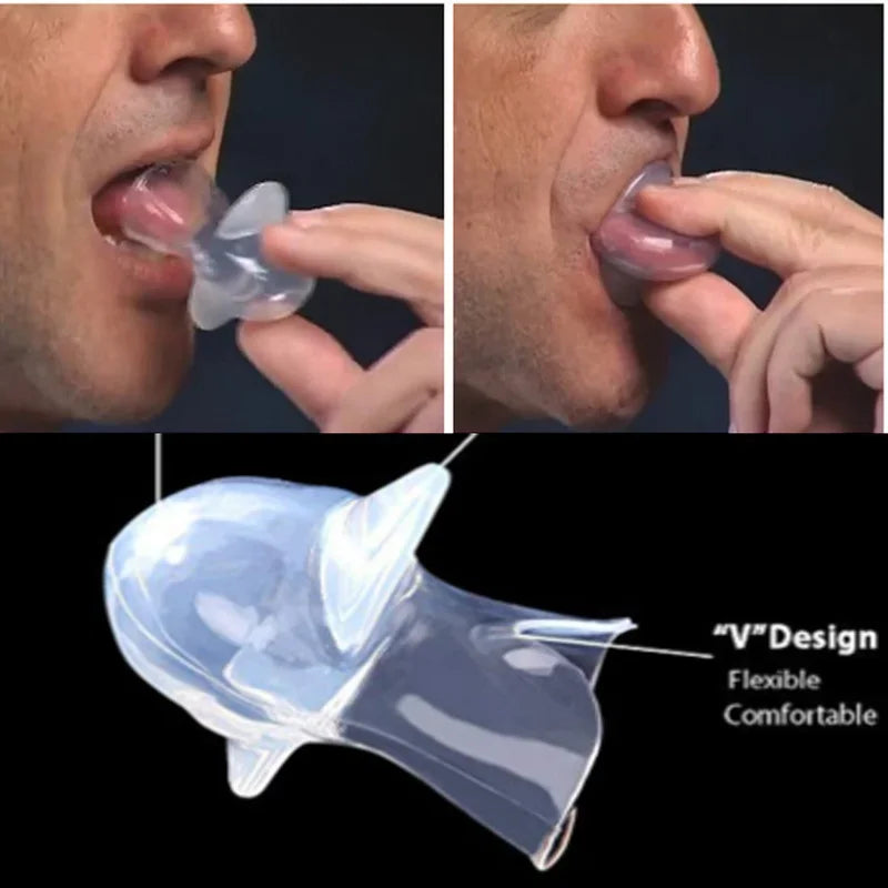 Medical Silicone Anti-Snore Tongue Retainer – Anti Snoring Mouthpiece for Sleep Apnea Relief